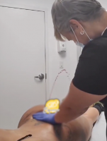 Screenshot of Instagram account showing Incisional Drainage being performed by "The Squeeze Lady"